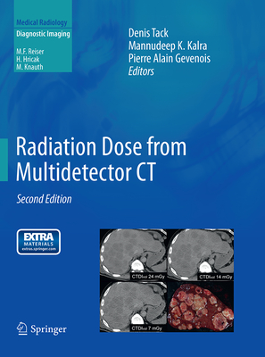 Radiation Dose from Multidetector CT - Tack, Denis (Editor), and Kalra, Mannudeep K (Editor), and Gevenois, Pierre Alain (Editor)