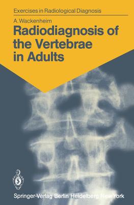 Radiodiagnosis of the Vertebrae in Adults: 125 Exercises for Students and Practitioners - Wackenheim, Auguste