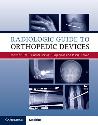 Radiologic Guide to Orthopedic Devices - Hunter, Tim B. (Editor), and Taljanovic, Mihra S. (Editor), and Wild, Jason R. (Editor)