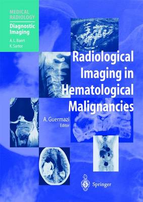 Radiological Imaging in Hematological Malignancies - Guermazi, Ali, MD, and Abdelwahab, I F, and Adem, C