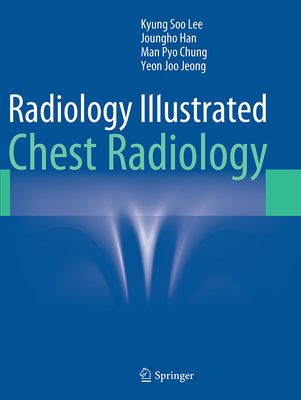 Radiology Illustrated: Chest Radiology - Lee, Kyung Soo, MD, and Han, Joungho, Dr., M.D., and Chung, Man Pyo