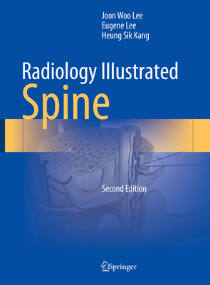 Radiology Illustrated: Spine - Lee, Joon Woo, and Lee, Eugene, and Kang, Heung Sik