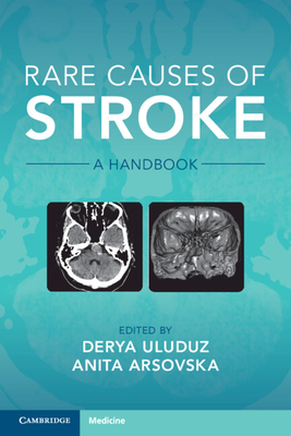 Rare Causes of Stroke: A Handbook - Uluduz, Derya (Editor), and Arsovska, Anita