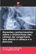 Recentes conhecimentos sobre a histiocitose das c?lulas de Langerhans que afecta a cabe?a e o pesco?o