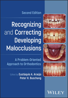 Recognizing and Correcting Developing Malocclusions: A Problem-Oriented Approach to Orthodontics - Arajo, Eustquio A. (Editor), and Buschang, Peter H. (Editor)