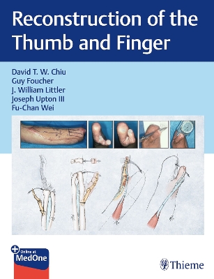 Reconstruction of the Thumb and Finger - Chiu, David (Editor), and Foucher, Guy (Editor), and Littler, J. William (Editor)