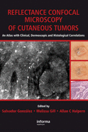 Reflectance Confocal Microscopy of Cutaneous Tumors: An Atlas with Clinical, Dermoscopic and Histological Correlations - Gonzalez, Salvador (Editor), and Gill, Melissa (Editor), and Halpern, Allan C (Editor)