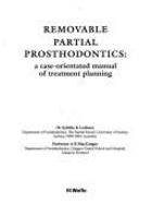Removable Partial Prosthodontics: A Case-Orientated Manual of Treatment Planning