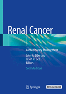 Renal Cancer: Contemporary Management