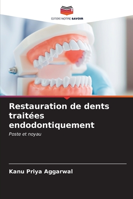 Restauration de dents trait?es endodontiquement - Aggarwal, Kanu Priya