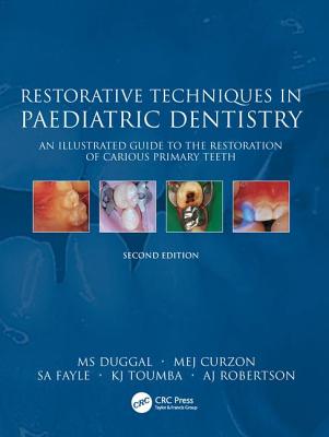 Restorative Techniques in Paediatric Dentistry: An Illustrated Guide to the Restoration of Extensive Carious Primary Teeth - Duggal, M S, and Cuzon, M E J, and Fayle, S A