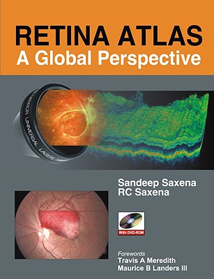 Retina Atlas: A Global Perspective - Saxena, Sandeep, and Saxena, R C