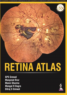 Retina Atlas - Grewal, SPS, and Brar, Manpreet, and Sharma, Mansi