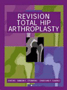 Revision Total Hip Arthroplasty - Steinberg, Marvin E (Editor), and Garino, Jonathan P, MD (Editor), and Steinberg, Daniel