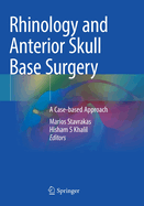 Rhinology and Anterior Skull Base Surgery: A Case-based Approach