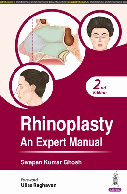 Rhinoplasty: An Expert Manual - Ghosh, Swapan Kumar