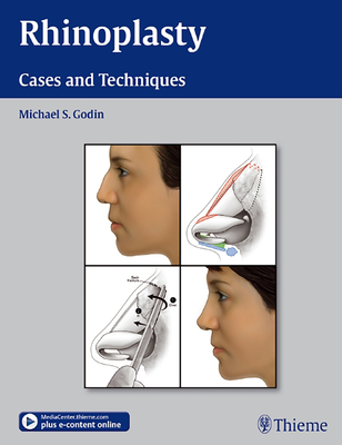 Rhinoplasty: Cases and Techniques - Godin, Michael S