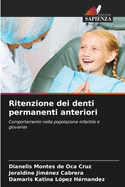 Ritenzione dei denti permanenti anteriori