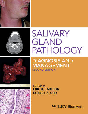Salivary Gland Pathology: Diagnosis and Management - Ord, Robert A., and Carlson, Eric R.