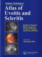 Sankara Nethralaya's Atlas of Uveitis and Scleritis