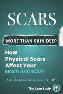 Scars: More Than Skin Deep: How Physical Scars Affect Your Body and Brain