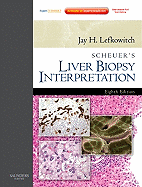 Scheuer's Liver Biopsy Interpretation: Expert Consult: Online and Print