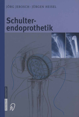 Schulterendoprothetik: Indikation, Implantate, Op-Technik, Nachbehandlung, Begutachtung - Attmanspacher, W, and Jerosch, Jrg, and Neer, C S (Preface by)