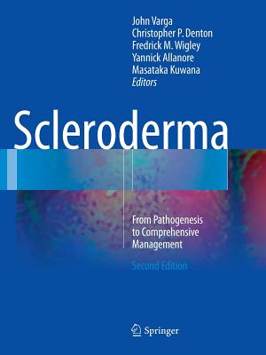 Scleroderma: From Pathogenesis to Comprehensive Management - Varga, John (Editor), and Denton, Christopher P (Editor), and Wigley, Fredrick M (Editor)