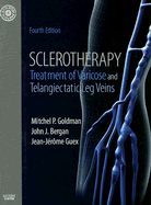 Sclerotherapy: Treatment of Varicose and Telangiectatic Leg Veins, Text with DVD - Goldman, Mitchel P, MD, and Bergan, John J, Hon., MD, Facs, and Guex, Jean-Jrme, MD