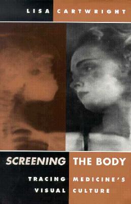 Screening the Body: Tracing Medicine's Visual Culture - Cartwright, Lisa