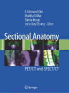 Sectional Anatomy: PET/CT and SPECT/CT - Kim, E Edmund (Editor), and Mar, Martha V (Editor), and Inoue, Tomio (Editor)