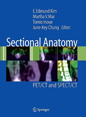 Sectional Anatomy: PET/CT and SPECT/CT - Kim, E Edmund (Editor), and Mar, Martha V (Editor), and Inoue, Tomio (Editor)