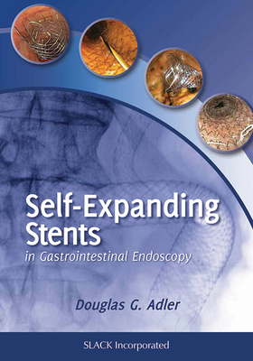 Self-Expanding Stents in Gastrointestinal Endoscopy - Adler, Douglas, MD