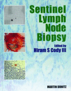 Sentinel Lymph Node Biopsy - Cody, Hiram S (Editor)