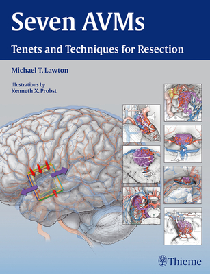 Seven Avms: Tenets and Techniques for Resection - Lawton, Michael T (Editor)