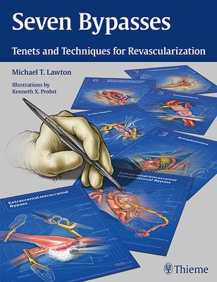 Seven Bypasses: Tenets and Techniques for Revascularization - Lawton, Michael T