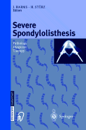 Severe Spondylolisthesis: Pathology - Diagnosis - Therapy