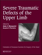 Severe Tramatic Defects of the Upper Limb: Published in Association with the Federation of European Societies for Surgery of the Hand