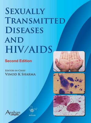 Sexually Transmitted Diseases and HIV & AIDS 2e - Sharma, Vinod K