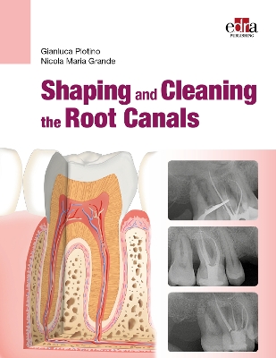 Shaping and Cleaning the Root Canal System - Plotino, Gianluca, and Grande, Nicola Maria