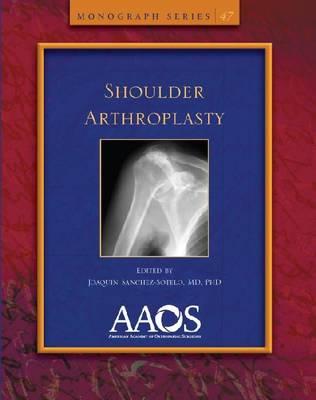 Shoulder Arthroplasty - Sanchez-Sotelo, Joaquin (Editor)