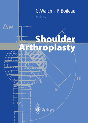 Shoulder Arthroplasty - Walch, Gilles, MD (Editor), and Boileau, Pascal (Editor), and Gschwend, N (Foreword by)