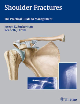 Shoulder Fractures: The Practical Guide to Management - Zuckerman, Joseph D, MD (Editor), and Koval, Kenneth (Editor)
