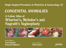 Single Surgical Procedures in Obstetrics and Gynaecology: Volume 32: Congenital Anomalies: A Colour Atlas of Wharton's, McIndoe's and Nagrath's Vaginoplasty