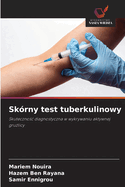 Sk?rny test tuberkulinowy