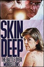 Skin Deep: The Battle Over Morgellons - Pi Ware