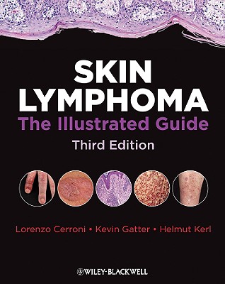 Skin Lymphoma: The Illustrated Guide - Cerroni, Lorenzo, M.D., and Gatter, Kevin, and Helmut, Kerl
