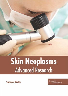 Skin Neoplasms: Advanced Research - Wells, Spencer (Editor)