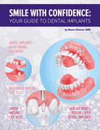 Smile with Confidence: Your Guide to Dental Implants