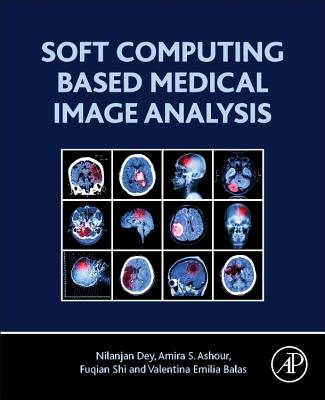 Soft Computing Based Medical Image Analysis - Dey, Nilanjan, and Ashour, Amira S., and Shi, Fuquian